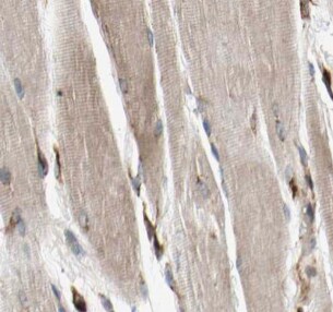 MYOM1 Antibody - BSA Free