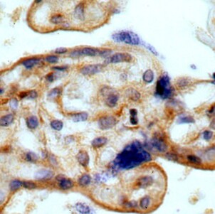 Myoferlin Antibody - BSA Free