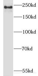 Myoferlin Antibody - BSA Free