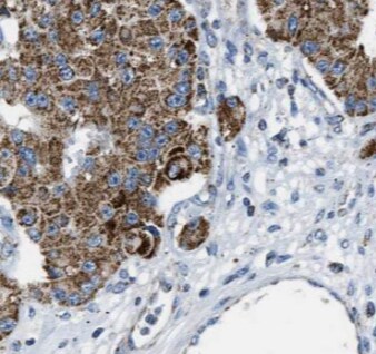 Myosin VIIb Antibody - BSA Free