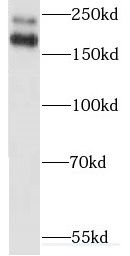 MYO18A Antibody - BSA Free