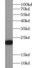 Fast skeletal myosin light chain 2 Antibody - BSA Free