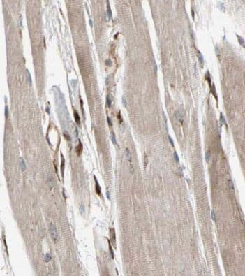 Fast skeletal myosin light chain 2 Antibody - BSA Free