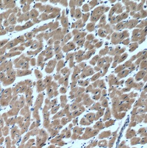 MYLK4 Antibody - BSA Free
