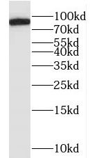 MYLK3 Antibody - BSA Free