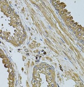 MYLIP Antibody - BSA Free