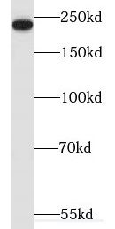 Myosin heavy chain 14 Antibody - BSA Free
