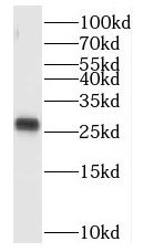 MYEOV2 Antibody - BSA Free