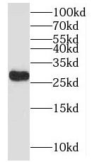 MYCT1 Antibody - BSA Free