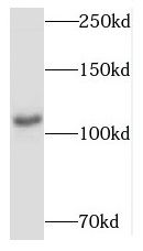 MYCBPAP Antibody - BSA Free