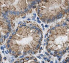 Mkln1 Antibody - BSA Free