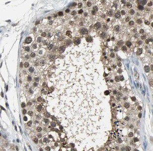 MUM1L1 Antibody - BSA Free