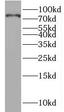 Mucolipin 3 Antibody - BSA Free