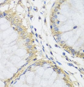 Metaxin 1 Antibody - BSA Free
