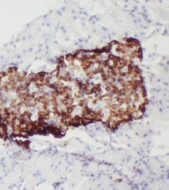 MTR Antibody - BSA Free