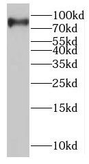 MTMR7 Antibody - BSA Free