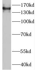 MTMR4 Antibody - BSA Free