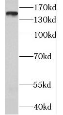 MTMR3 Antibody - BSA Free