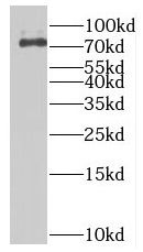 MTMR12 Antibody - BSA Free