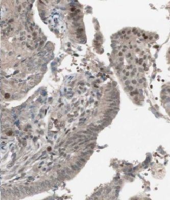 MSY2 Antibody - BSA Free