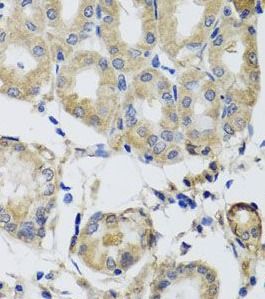 MRPS22 Antibody - BSA Free