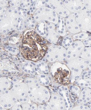 MRPS21 Antibody - BSA Free