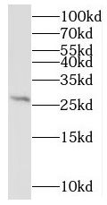 MRPL9 Antibody - BSA Free