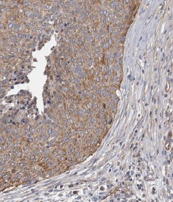 MRPL3 Antibody - BSA Free