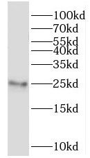 MRPL24 Antibody - BSA Free