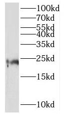 MRPL21 Antibody - BSA Free