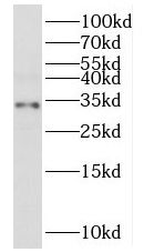 MRPL2 Antibody - BSA Free