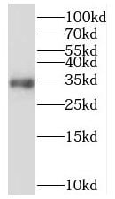 MRPL15 Antibody - BSA Free
