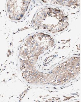 MRPL10 Antibody - BSA Free
