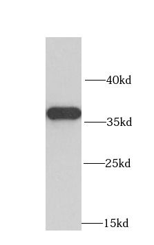 MRPL1 Antibody - BSA Free