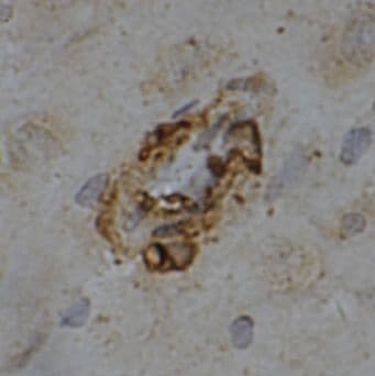 MRAP2 Antibody - BSA Free