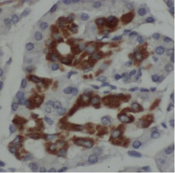 MPV17 Antibody - BSA Free