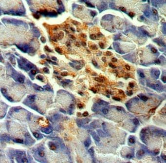 MPPED1 Antibody - BSA Free