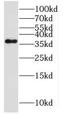MPPED1 Antibody - BSA Free