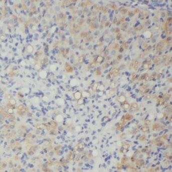 MPP7 Antibody - BSA Free