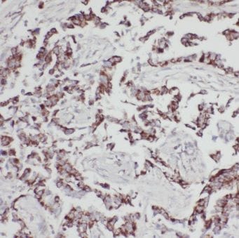 MPP3 Antibody - BSA Free
