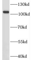 MORC1 Antibody - BSA Free
