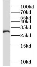 MOGAT2 Antibody - BSA Free