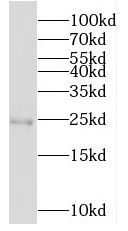 MOBKL3 Antibody - BSA Free