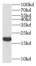 UEV2 Antibody - BSA Free