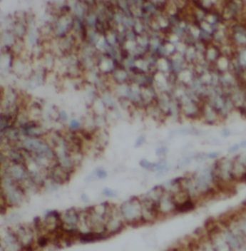 UEV2 Antibody - BSA Free