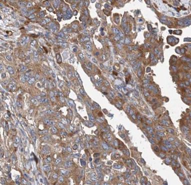 MMP23B Antibody - BSA Free