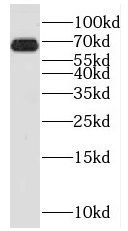 MMP21 Antibody - BSA Free