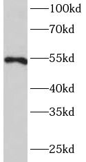 MMP20 Antibody - BSA Free