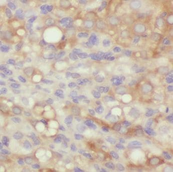 MMAB Antibody - BSA Free