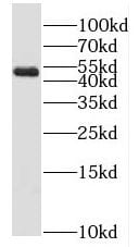 MLYCD Antibody - BSA Free